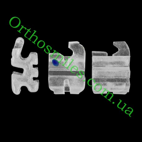Керамічні брекети Mini фото 1 — OrthoSmiles