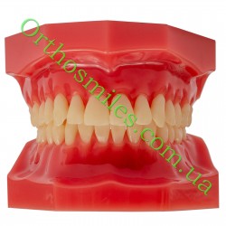 Типодонт (модель зубов) с брекетами