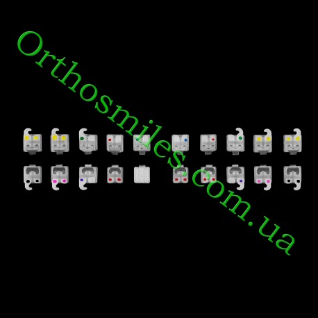 Керамічні самолігуючі брекети Dinamique З від ТМ Dentaurum фото 1 — OrthoSmiles