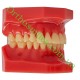 Типодонт (модель зубів) без брекетів фото 3 — OrthoSmiles