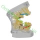 Типодонт (модель зубів) з комбінованими  брекетами фото 4 — OrthoSmiles