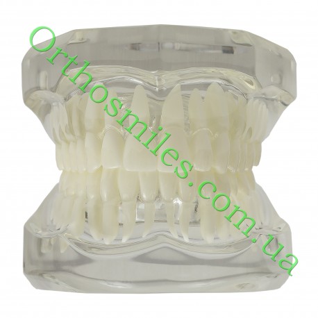 Типодонт  прозорий  рівні зуби фото 1 — OrthoSmiles